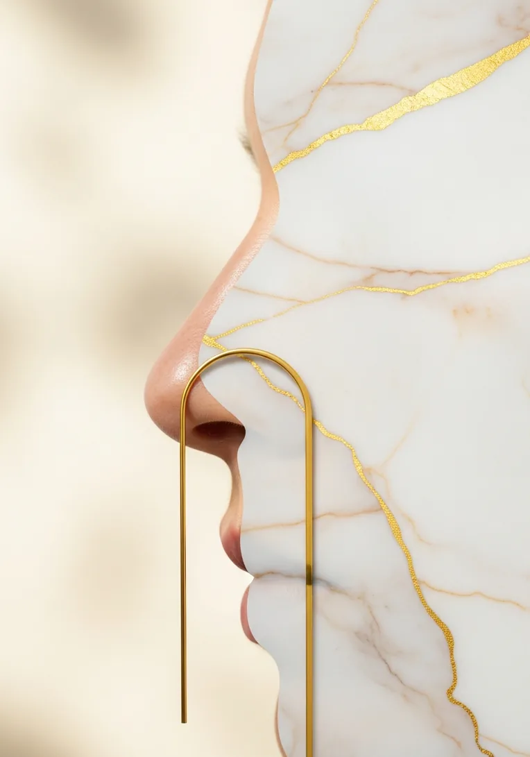 Nasal Valve Collapse
